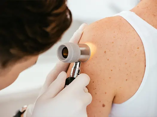 Cancro de pele