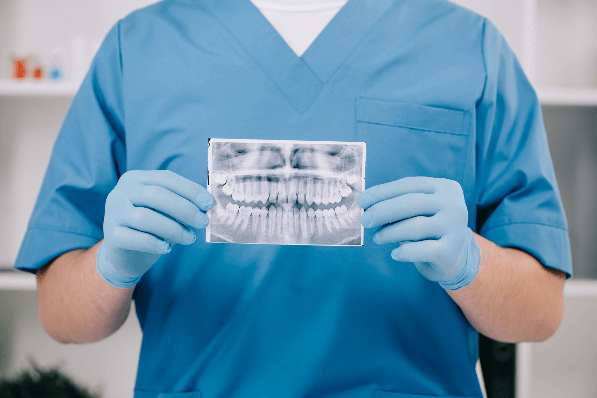 Dentes desgastados ou fraturados