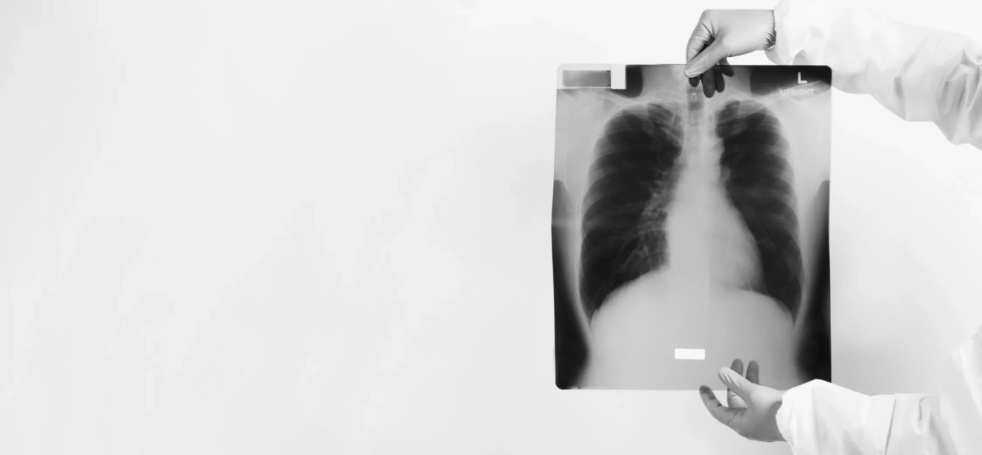 Pneumologia - cuide da sua saúde respiratória