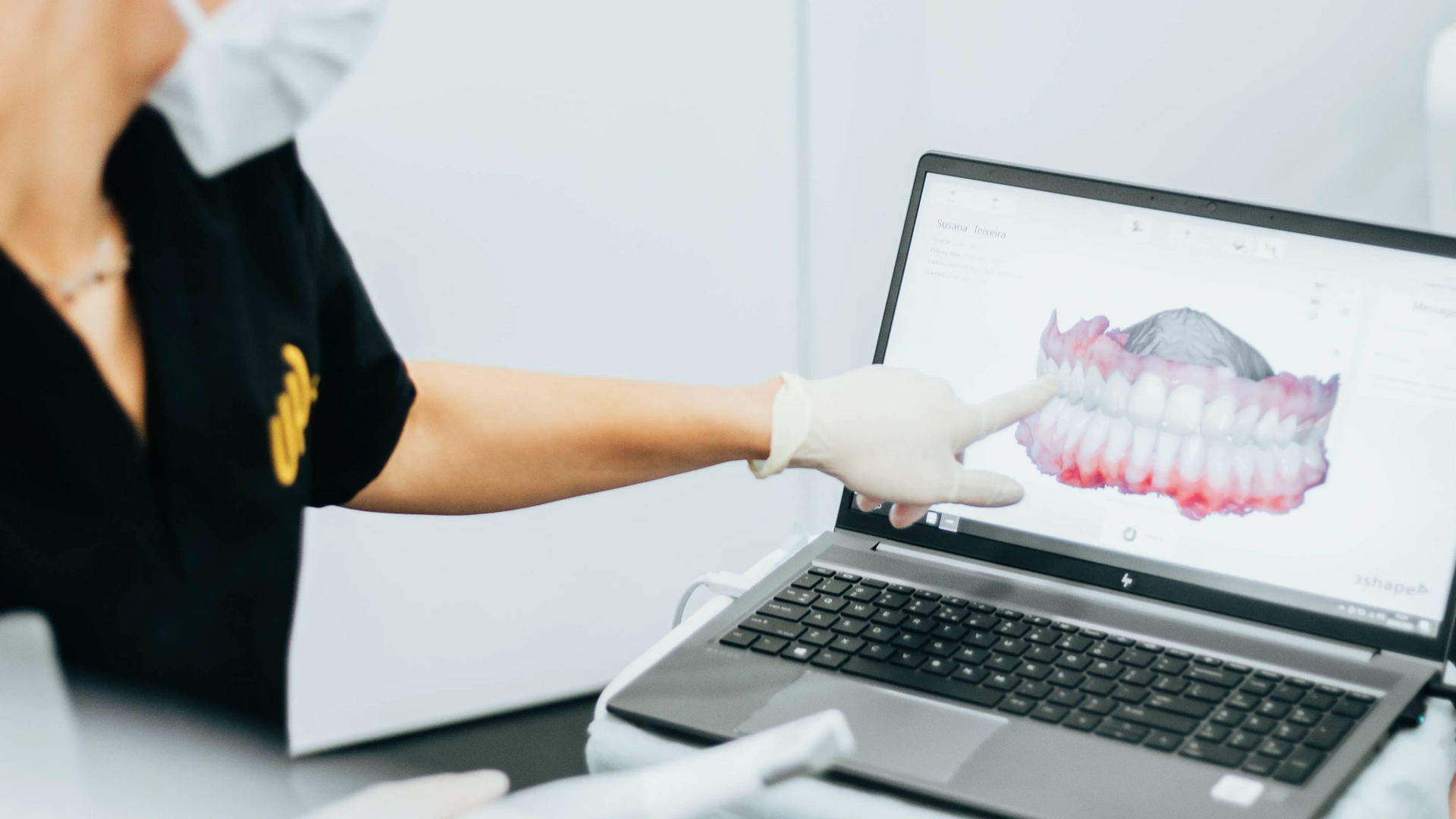 Os Benefícios dos Implantes Dentários
