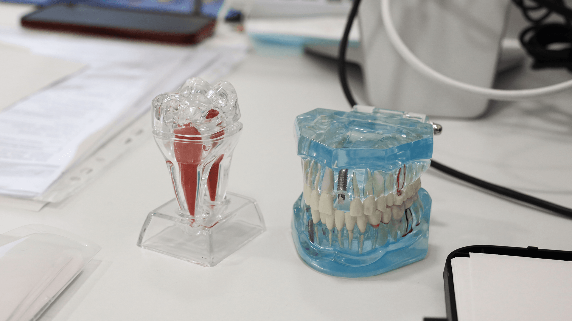 O que é a Oclusão Dentária e por que é tão importante?