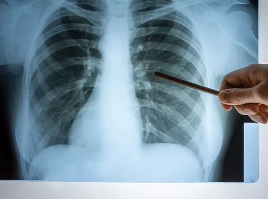 Recuperação pós-COVID ou após gripes fortes