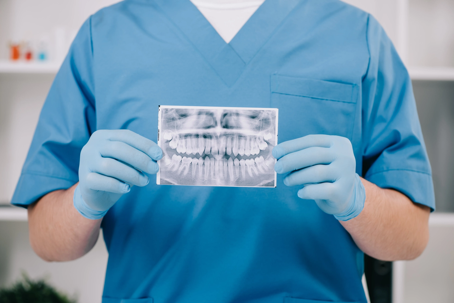 Dentes desgastados ou fraturados