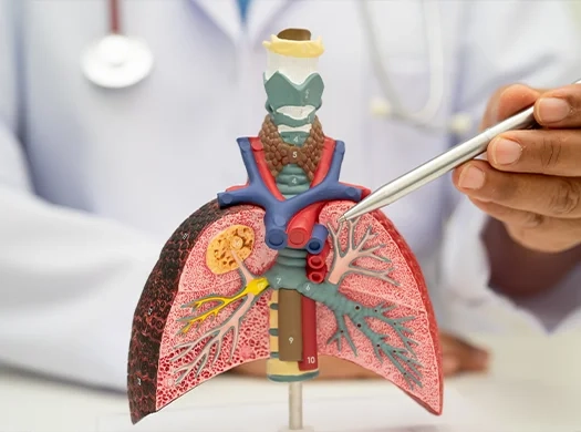 Infeções respiratórias recorrentes ou complicadas