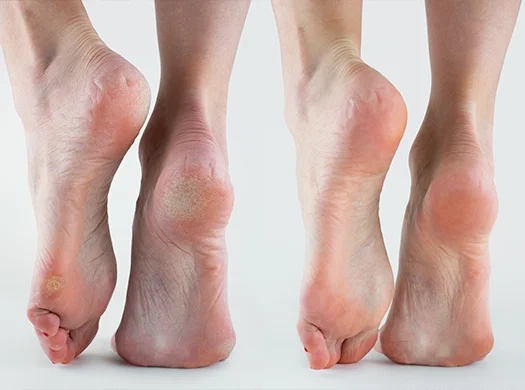 Deformações estruturais (joanetes, dedos em garra, etc.)