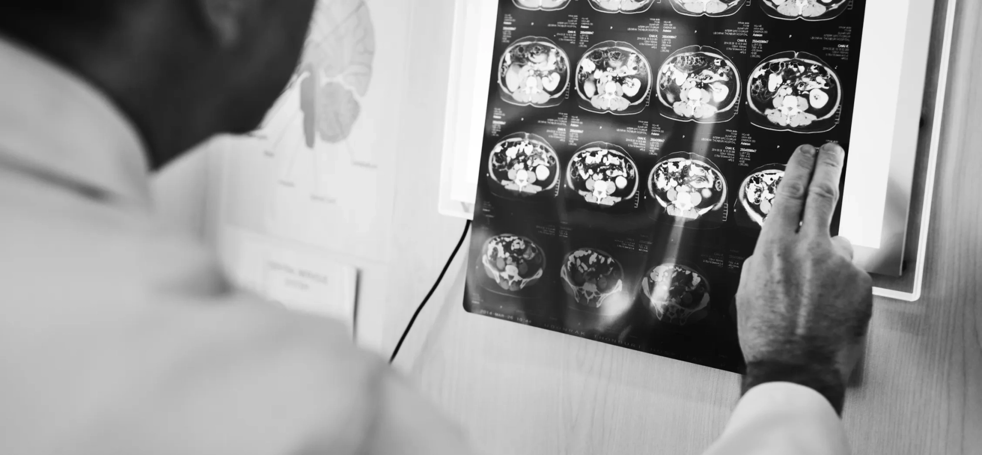 Quando devo consultar um neurologista?