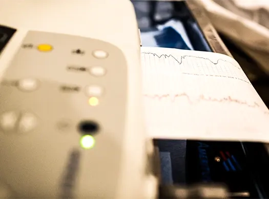 Arritmias cardíacas