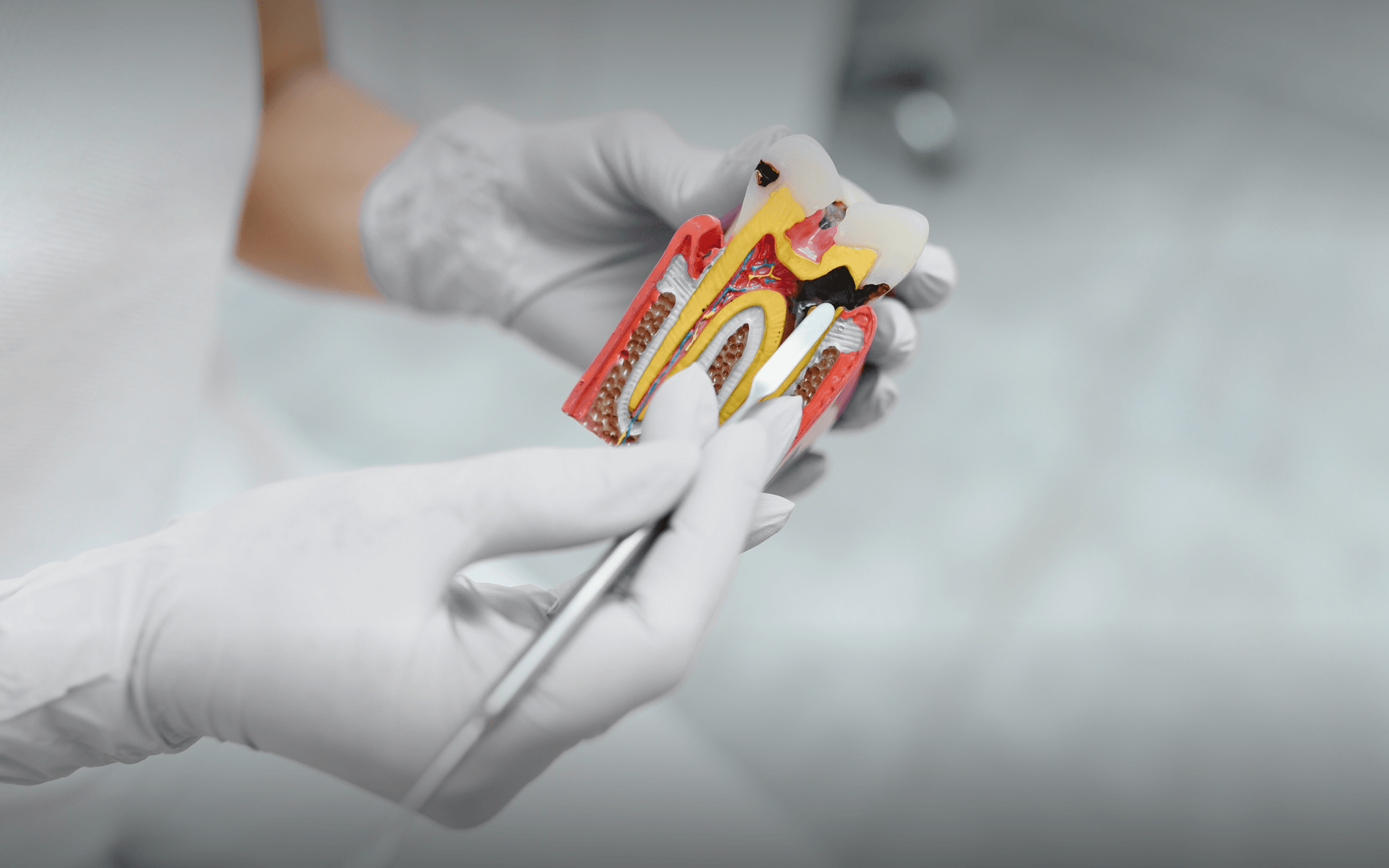 Banner Endodontia